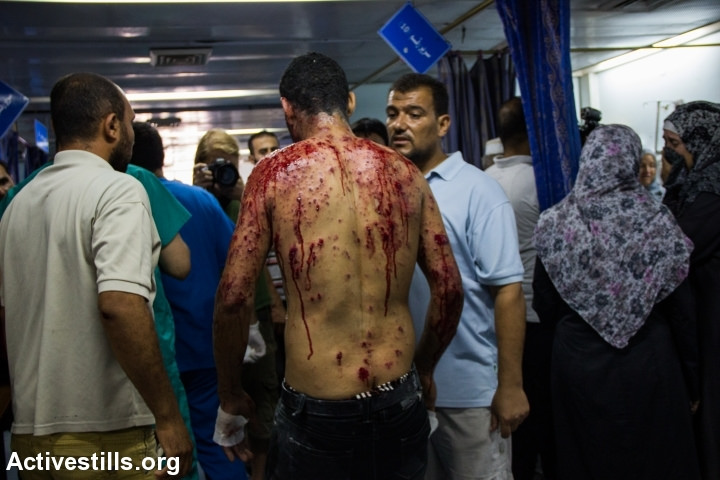 one of the injured after unrwa school shelling